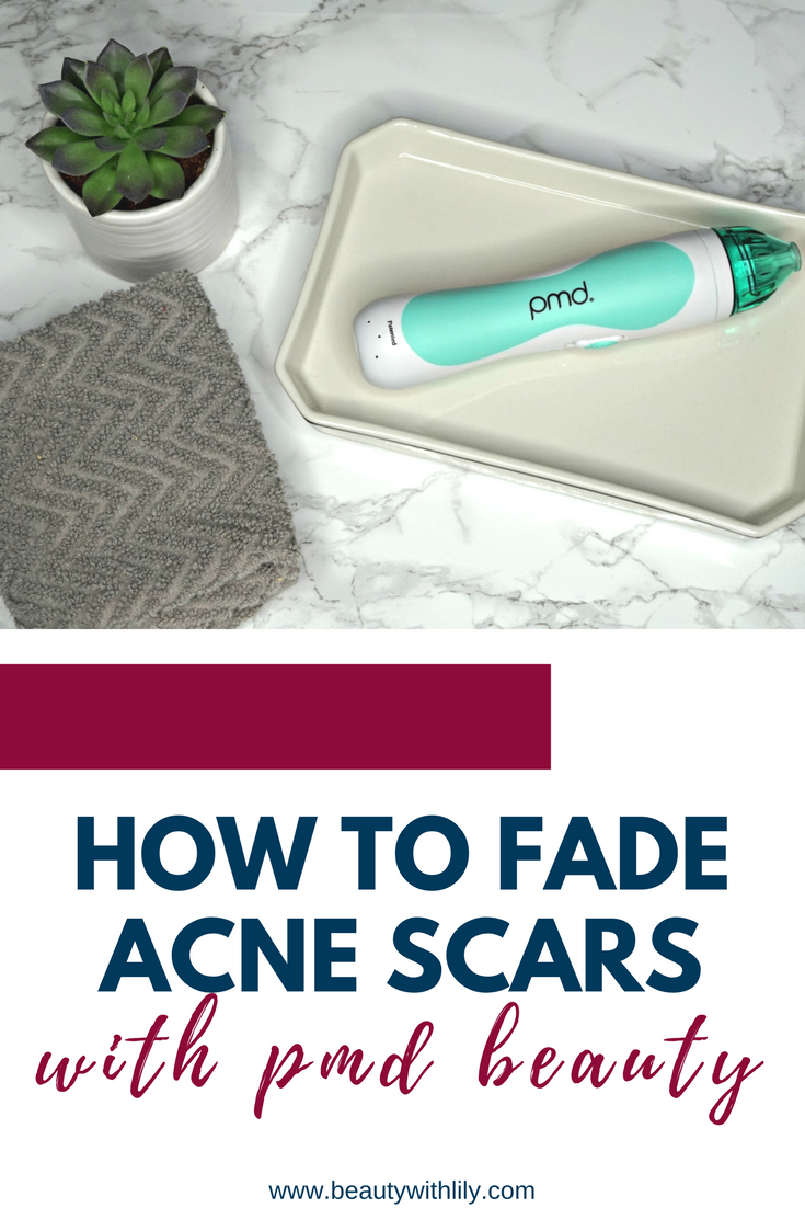 How To Fade Acne Scars With PMD Beauty / Get clear, radiant skin with this at-home microdermabrasion system! | Beauty With Lily | #ad http://primp.in/g0ZqIt2FL6 